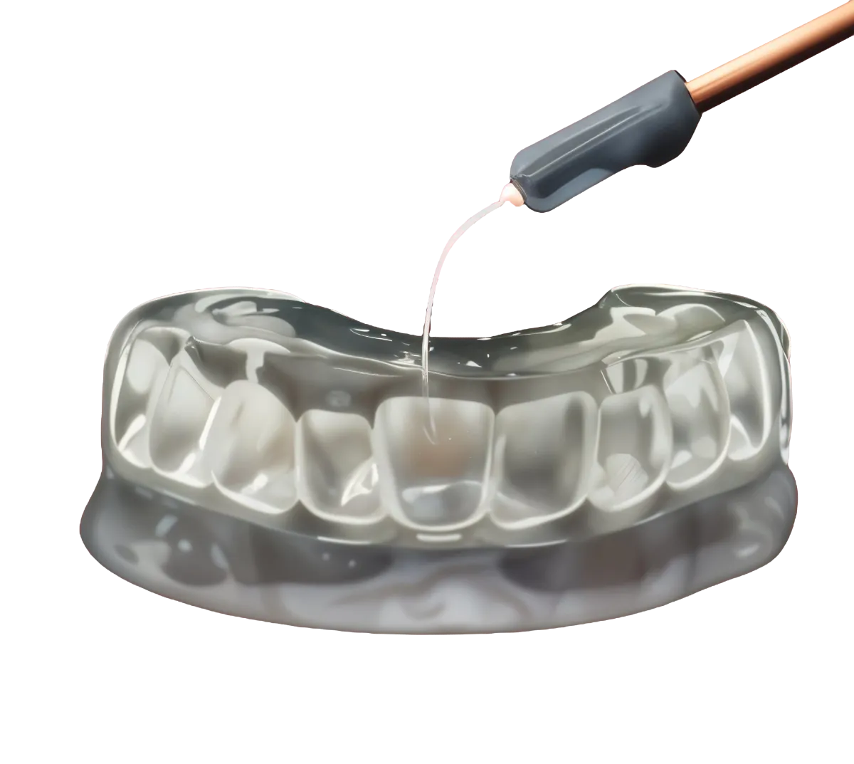 Clear Stent for Composite Injection
