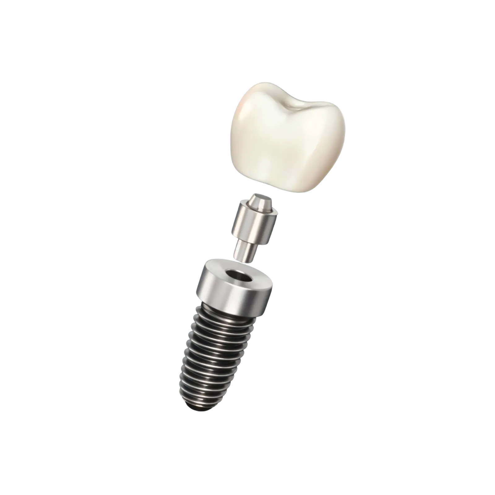 Dental Implants
