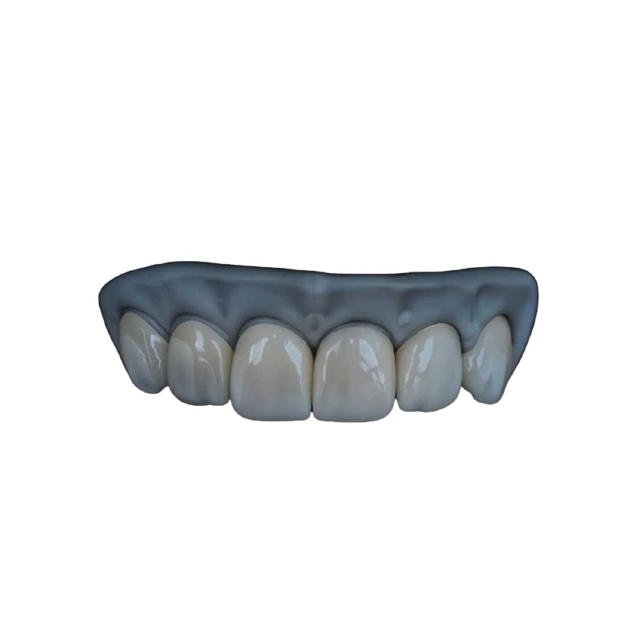 Porcelain Veneers